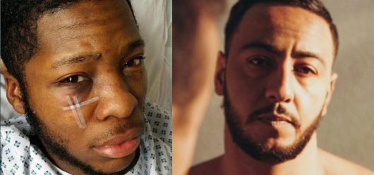 Lacrim apporte son soutien à Théo, victime d’une bavure policière !