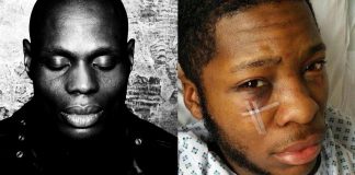 Kery James : son magnifique geste pour Théo, victime d’une bavure policière !
