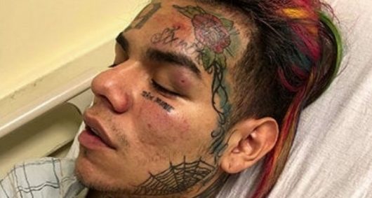 6ix9ine kidnappé et battu par 3 individus armés, le rappeur finit à l’hôpital !