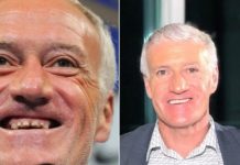 Didier Deschamps s’offre une nouvelle dentition et fait un buzz énorme sur la toile !