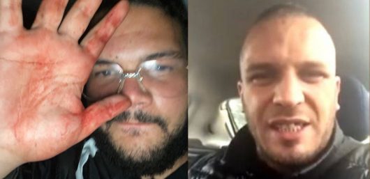Sadek déplore son agression sur Bassem et va assumer, J'ai céder comme un imbécile à la violence
