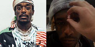 Lil Uzi Vert va se faire poser un diamant de 20 millions de dollars sur le front