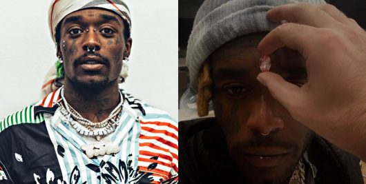 Lil Uzi Vert va se faire poser un diamant de 20 millions de dollars sur le front