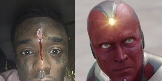 Lil Uzi Vert lynché sur Twitter après avoir frôlé la mort avec son piercing