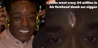 « Je pourrais mourir », commente Lil Uzi Vert, le visage en sang après son piercing diamanté