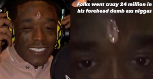 Lil Uzi Vert déjà le visage en sang après son piercing diamanté sur le front