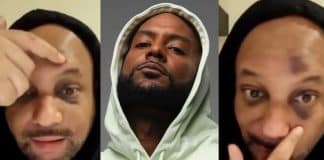 Booba pique Matt Houston qui clame sa vengeance le visage recouvert d’hématomes