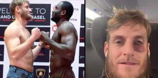 MMA : Ragnar Le Breton s’est fait démonter et s’affiche bien amoché