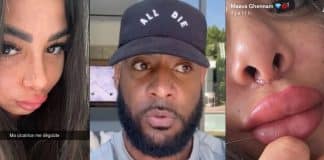 Booba ridiculise Maeva Ghennam qui vit un cauchemar avec sa chirurgie ratée