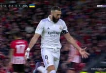 Les photos de l’horrible blessure de Benzema